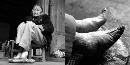 (miniature) A la découverte des derniers pieds bandés de Chine