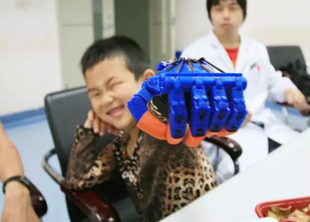 (miniature) Chine : La première main artificielle imprimée en 3D, offerte à un enfant