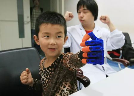 (miniature) Chine : La première main artificielle imprimée en 3D, offerte à un enfant