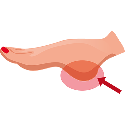 Heel in Chinese