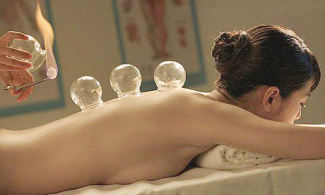 cupping therapy