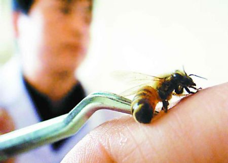(miniature) Thérapie par piqûres d'abeille